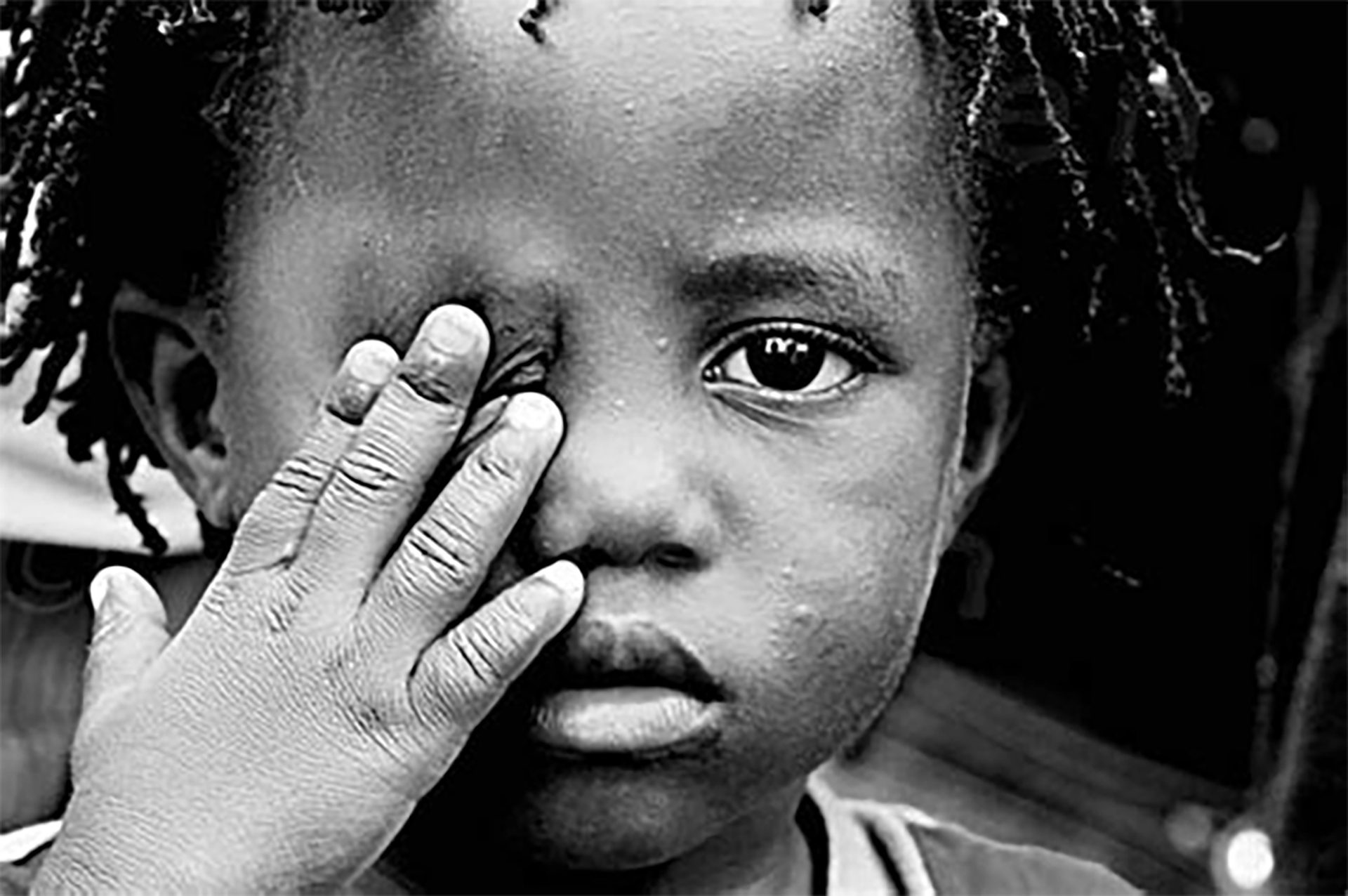 Starving Child2